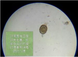 不了解这些驱虫要点 不能彻底驱虫