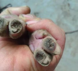 母猪蹄裂可不是小事，千万要重视！