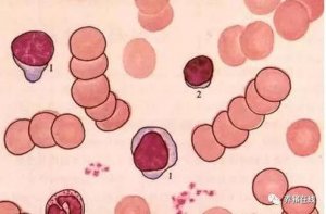 球蛋白、高免血清等抗体类生物制品的临床应用