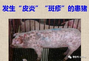 10种常见皮肤病典型特征 准确诊断皮肤病