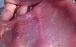 猪胎衣上黄白色溃疡灶的原因分析及防控