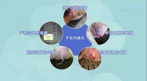 深度剖析：如何防控母猪子宫炎？提高母猪利用