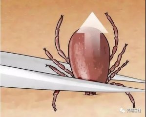 【技术】如何消灭蜱虫？